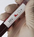 Минздрав Республики Коми призывает жителей пройти тест на ВИЧ