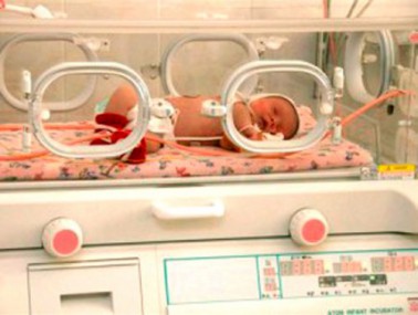Информация для родителей недоношенных детей, родившихся до 35 недель гестационного возраста
